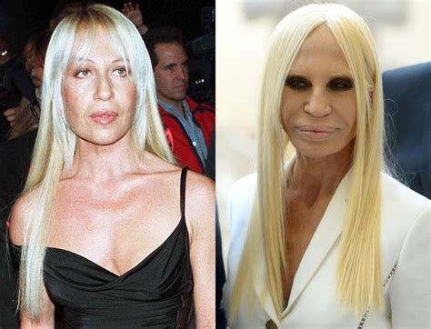 quando e nato donatella versace|donatella versace before and after surgery.